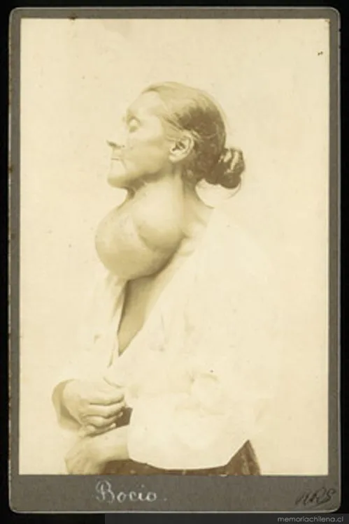 Bocio — 1900 | Chile de Ayer