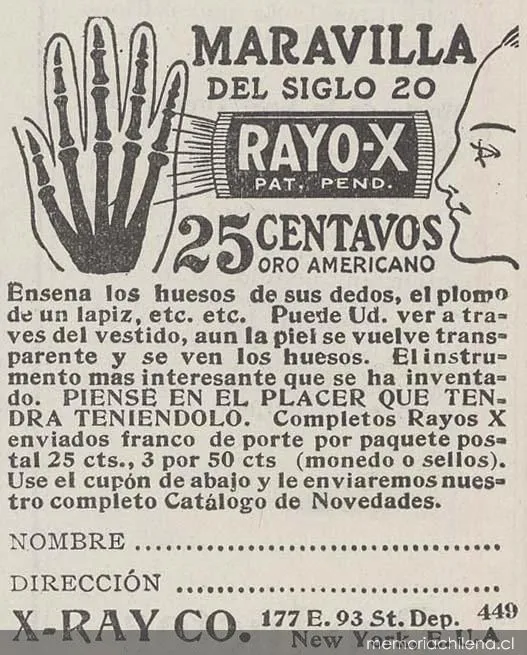 Maravilla del siglo 20: rayo-X — 1916 | Chile de Ayer