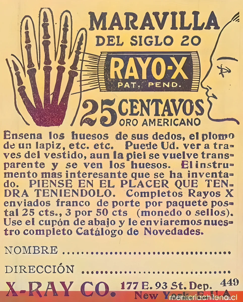 Maravilla del siglo 20: rayo-X — 1916 | Chile de Ayer